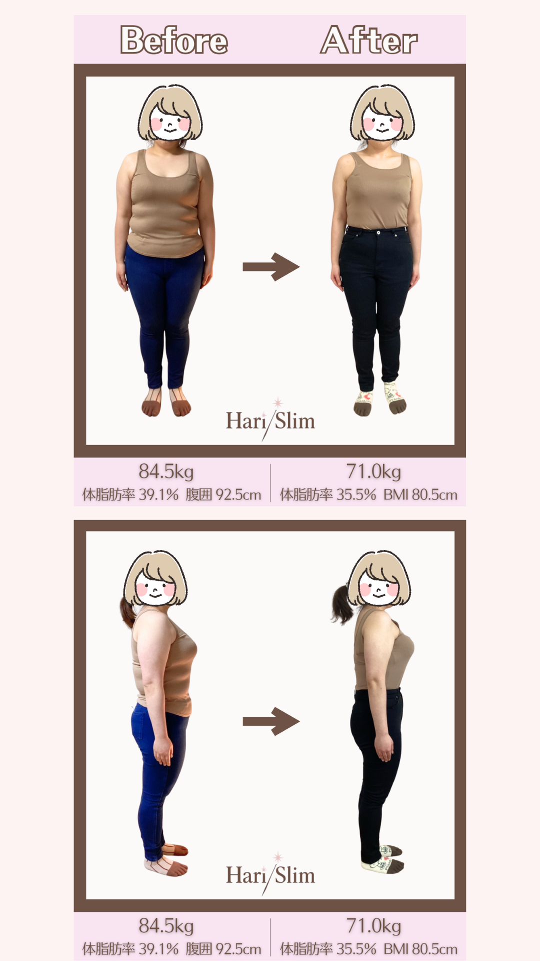 ビフォーアフター①