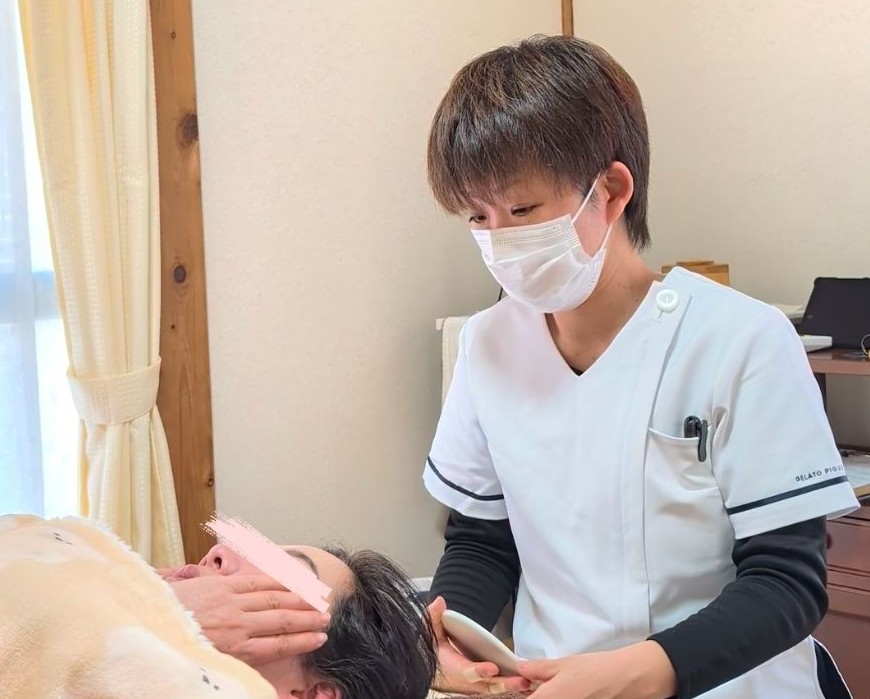 美容鍼の施術の様子